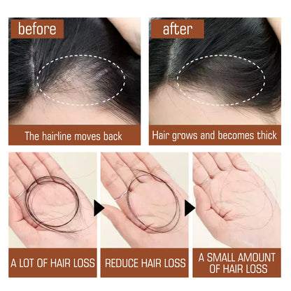 EELHOE Batana Oil Hair Conditioner for Nourishing Care